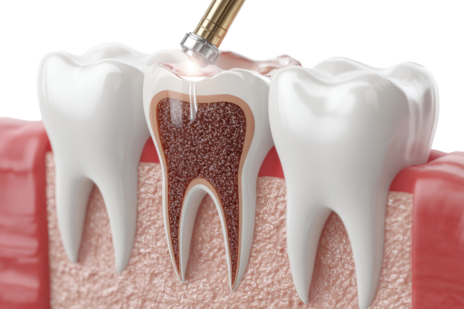 Tooth-coloured fillings — Easy Smiles Dentistry, Windsor