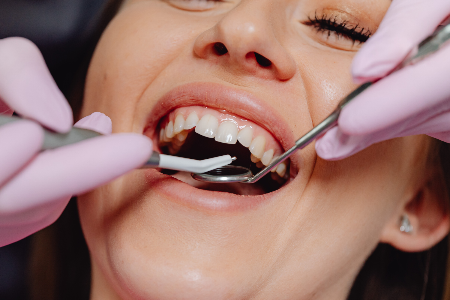 Emergency dentistry — Easy Smiles Dentistry, Windsor